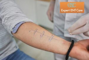 Allergy testing at Expert ENT Care in Fort Worth